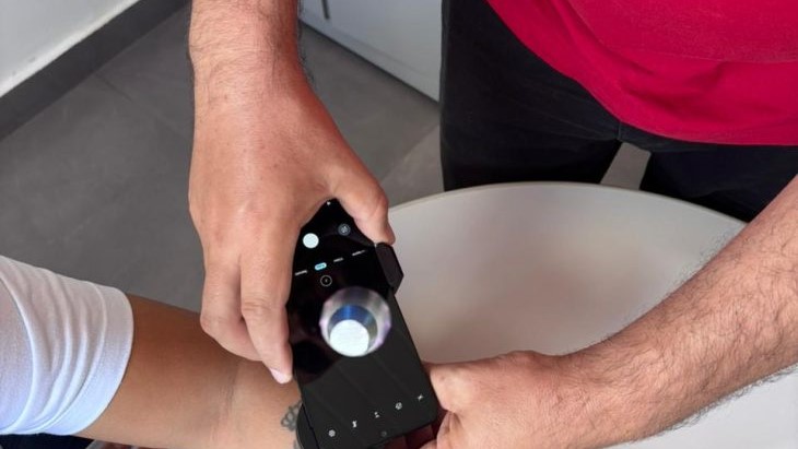 Telediagnóstico em dermatologia amplia acesso e identifica casos de câncer de pele em MS