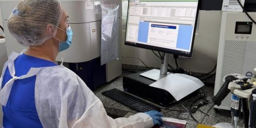 Foto: Divulgação SES