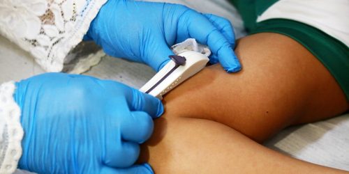 Contraceptivo de longa duração já está sendo oferecido às mulheres na rede pública de saúde de Dourados através da Rede Alyne. Foto: Divulgação/Assecom