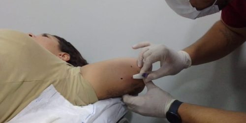 Métodos contraceptivos: saiba como acessar DIU e implante subdérmico pelo SUS em MS