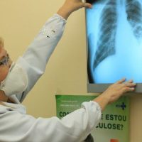 CRTH capacita equipes de saúde após aumento de casos de tuberculose em Dourados