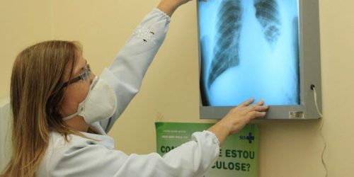 CRTH capacita equipes de saúde após aumento de casos de tuberculose em Dourados